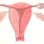Giải đáp chi tiết: Mổ nội soi thai ngoài tử cung thế nào?