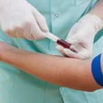 Các chỉ số xét nghiệm sinh hóa máu