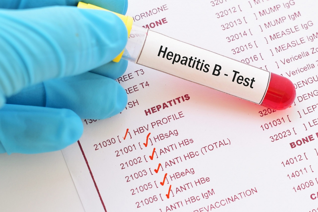 Tìm hiểu chỉ số hbv-dna pcr định lượng là gì và ảnh hưởng của nó đến sức khỏe