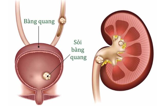 soi bang quang 2 e1681297805326