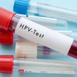 Xét nghiệm HPV là gì? Xét nghiệm HPV giá bao nhiêu?