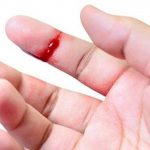 6 Cách cầm máu khi bị đứt tay đơn giản, bạn chớ bỏ qua
