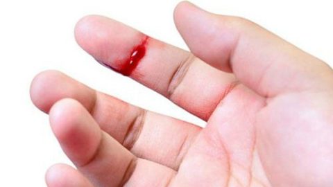 6 Cách cầm máu khi bị đứt tay đơn giản, bạn chớ bỏ qua