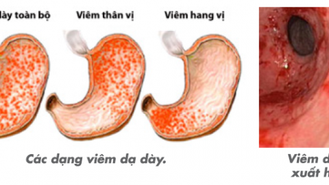 Thông tin về Tai Mũi Họng TCI Hospital- Trang 61 trên 91