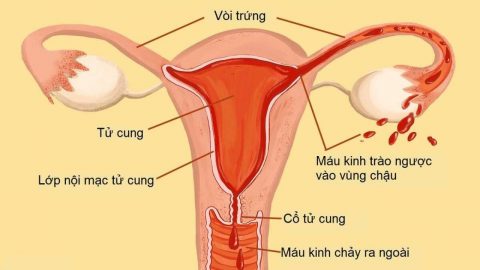 Niêm mạc tử cung dày là báo hiệu gì?