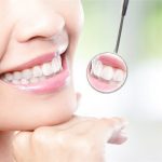 Liệu trình chăm sóc răng miệng tiêu chuẩn Nhật Bản