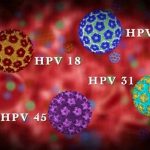 Góc giải đáp: Các nguyên nhân nhiễm virus hpv là gì?