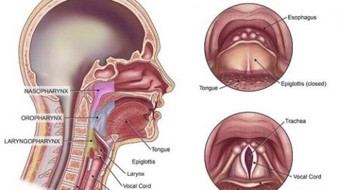 Ung thư vòm họng có chữa được không? các lưu ý