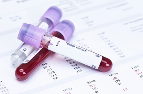 Ngoài thuốc, có những phương pháp điều trị tự nhiên nào cho ure máu cao?
