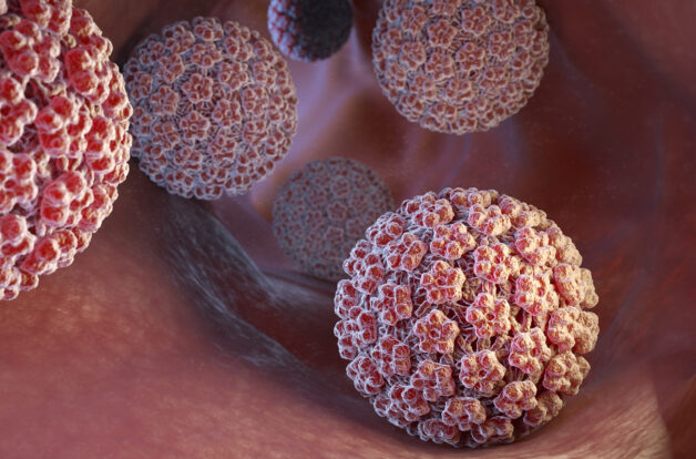 Ung thư cổ tử cung hình thành thường là do Human Papillomavirus (HPV).
