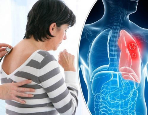 Đau sau lưng liên quan đến phổi có thể xuất hiện ở vị trí nào?
