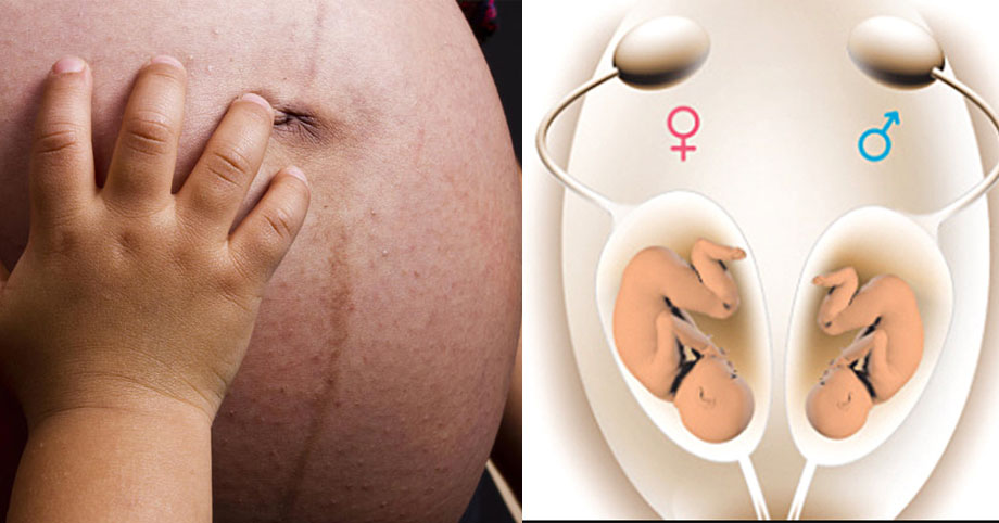 Xác định giới tính thai nhi sớm sẽ giúp các mẹ bầu phần nào giải đáp được những tò mò em bé trong bụng là con trai hay con gái