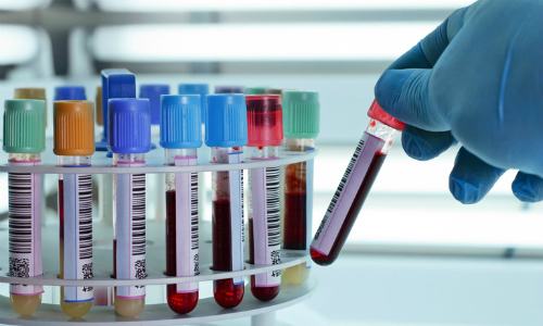 Nhóm máu hiếm có ảnh hưởng đến quá trình khám chữa bệnh không? Nếu có, tại sao?
