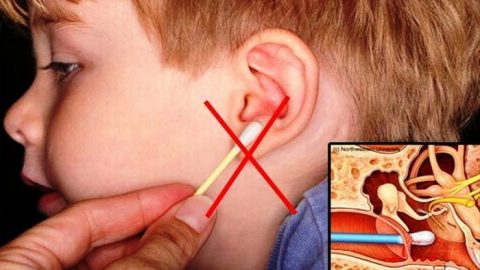 Nguyên nhân gây viêm tai ngoài là gì?