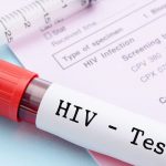 Xét nghiệm HIV bao lâu thì có kết quả