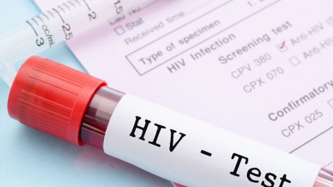 Xét nghiệm HIV bao lâu thì có kết quả