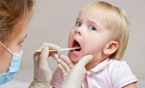 Viêm amidan là bệnh rất hay gặp ở trẻ