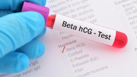 Xét nghiệm beta hCG và những điều cần biết