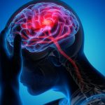 Khám nội thần kinh là gì, khám ở đâu và cần lưu ý gì?
