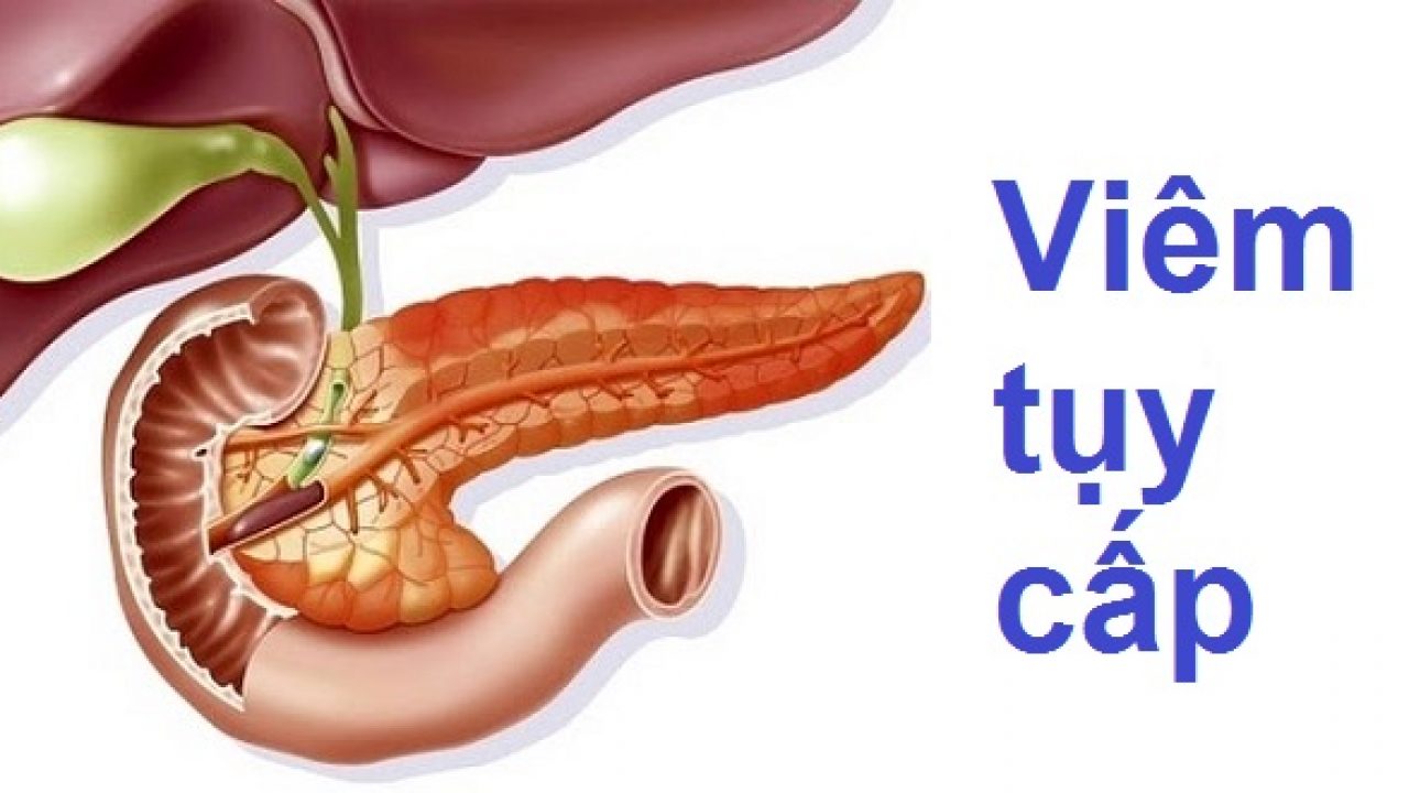 Bệnh viêm tụy cấp và cách chữa trị | TCI Hospital