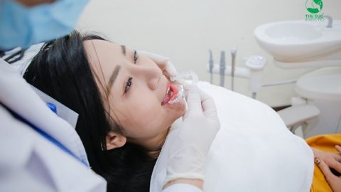 Mặt thon gọn khi niềng răng Invisalign – Liệu có đúng?