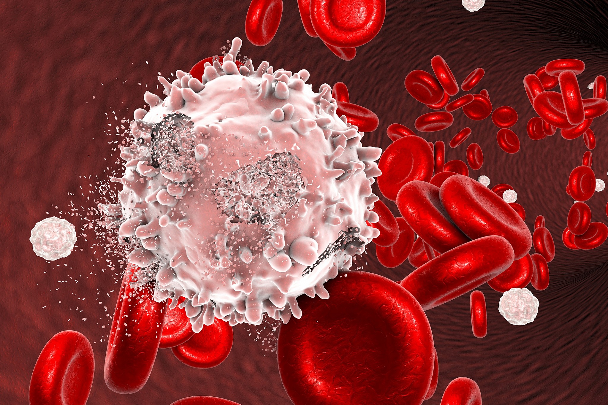 Ung thư máu cấp tính là gì và tác động của nó đến sống lượng sống của người mắc?
