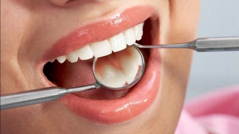 Lấy cao răng có tốt không? phòng tránh các bệnh răng miệng