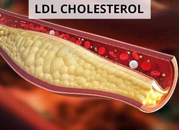 4. Các Yếu Tố Ảnh Hưởng Đến Mức LDL Cholesterol