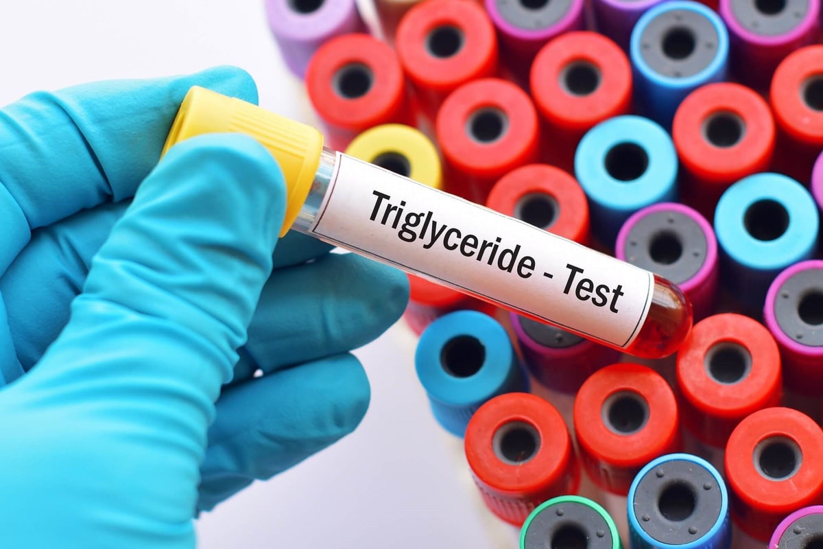 Định lượng triglycerid ở đâu TỐT? | TCI Hospital