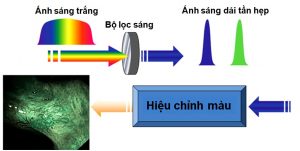 Tìm hiểu nội soi nbi là gì và ứng dụng trong lĩnh vực y tế