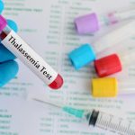 Làm thế nào để phát hiện bệnh thalassemia (tan máu bẩm sinh)?