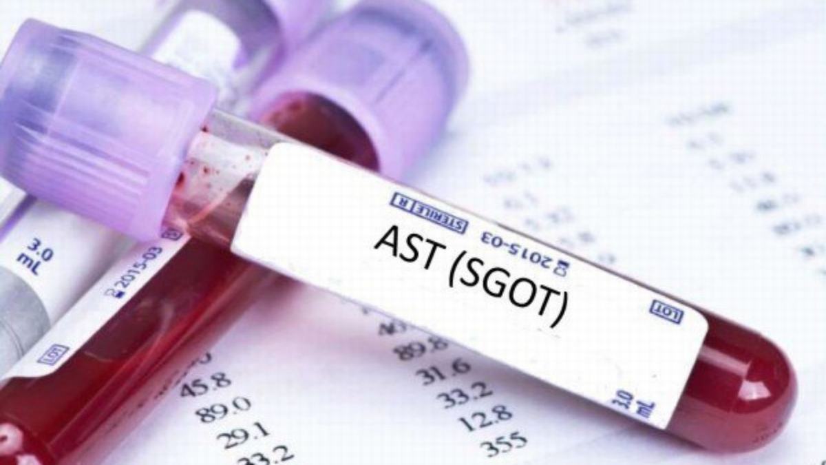 SGOT là viết tắt của từ gì trong xét nghiệm máu?
