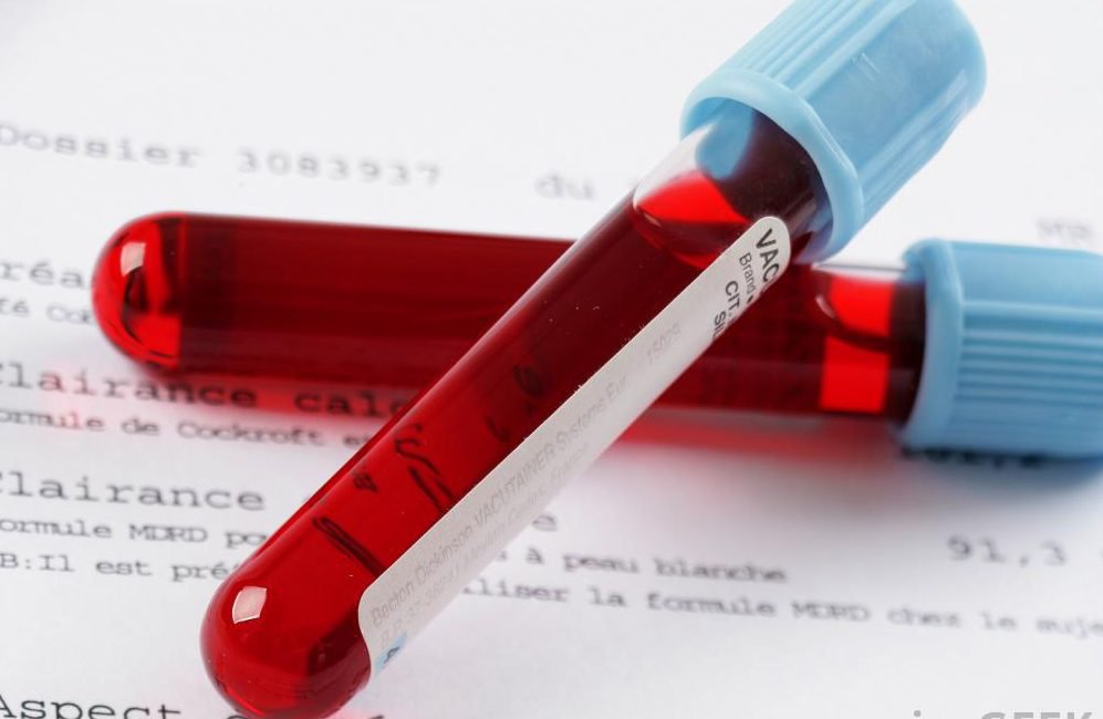 Tại sao PLT là chỉ số quan trọng trong xét nghiệm máu?
