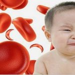 Thiếu máu ở trẻ em nguyên nhân và cách điều trị