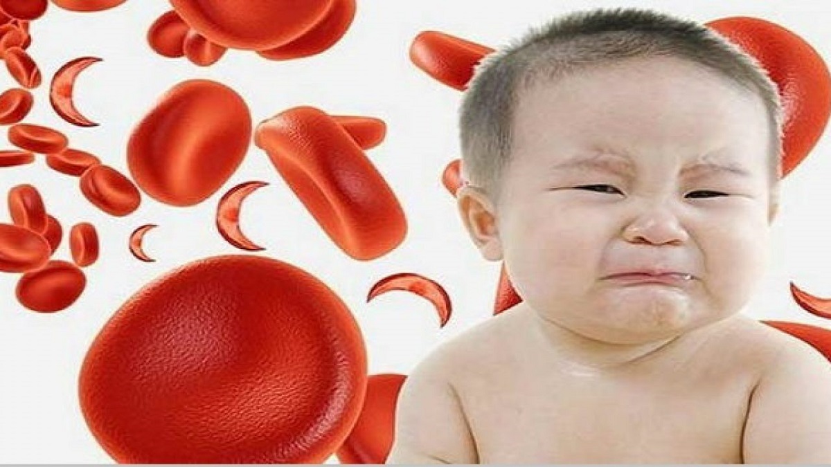 Làm thế nào để điều trị thiếu máu ở trẻ em?
