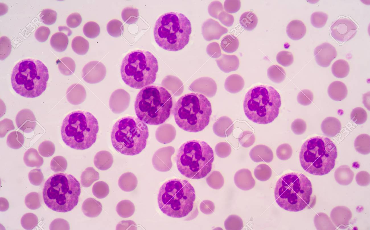 Neutrophils trong xét nghiệm máu là gì?