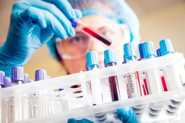 Xét nghiệm SGOT là một trong những xét nghiệm được chỉ định đối với bệnh nhân gặp các vấn đề về gan. (ảnh minh họa)