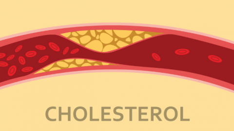 Cholesterol trong máu cao coi trừng mắc bệnh về tuyến giáp