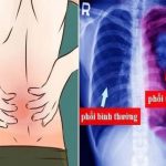 Những nguyên nhân gây đau lưng ở nam giới ít người nghĩ đến