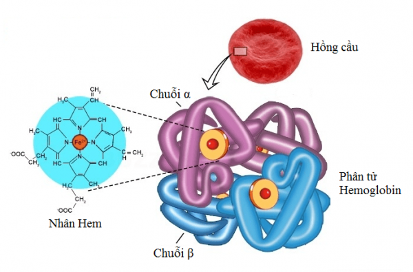 Bệnh huyết sắc tố là gì? Cách phát hiện sớm bệnh lý huyết sắc tố