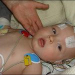 Viêm màng não ở trẻ em có nguy hiểm không?