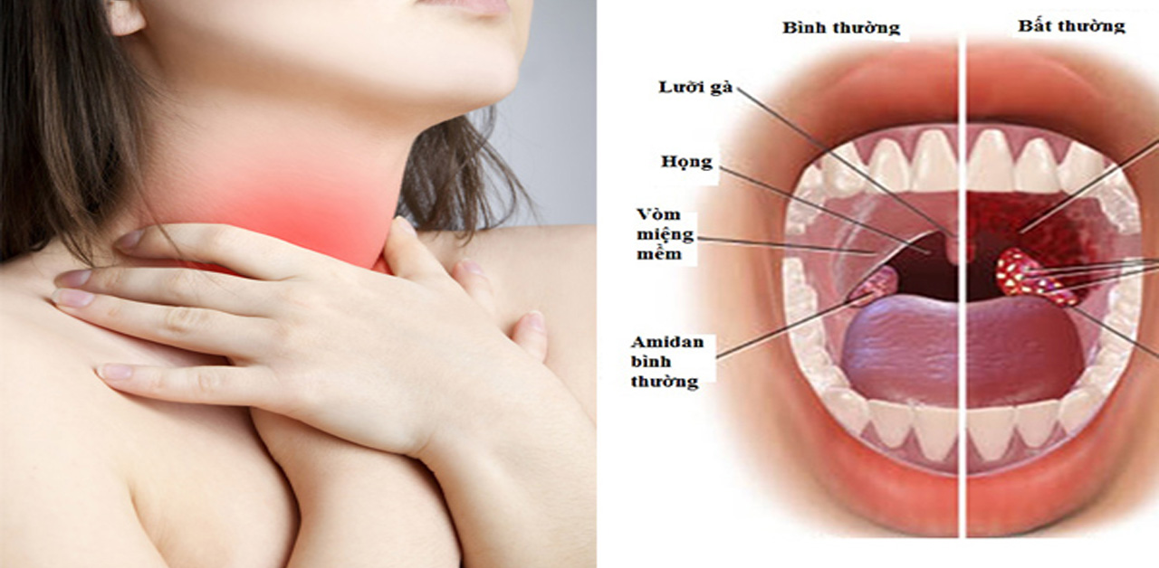 Các biện pháp phòng ngừa