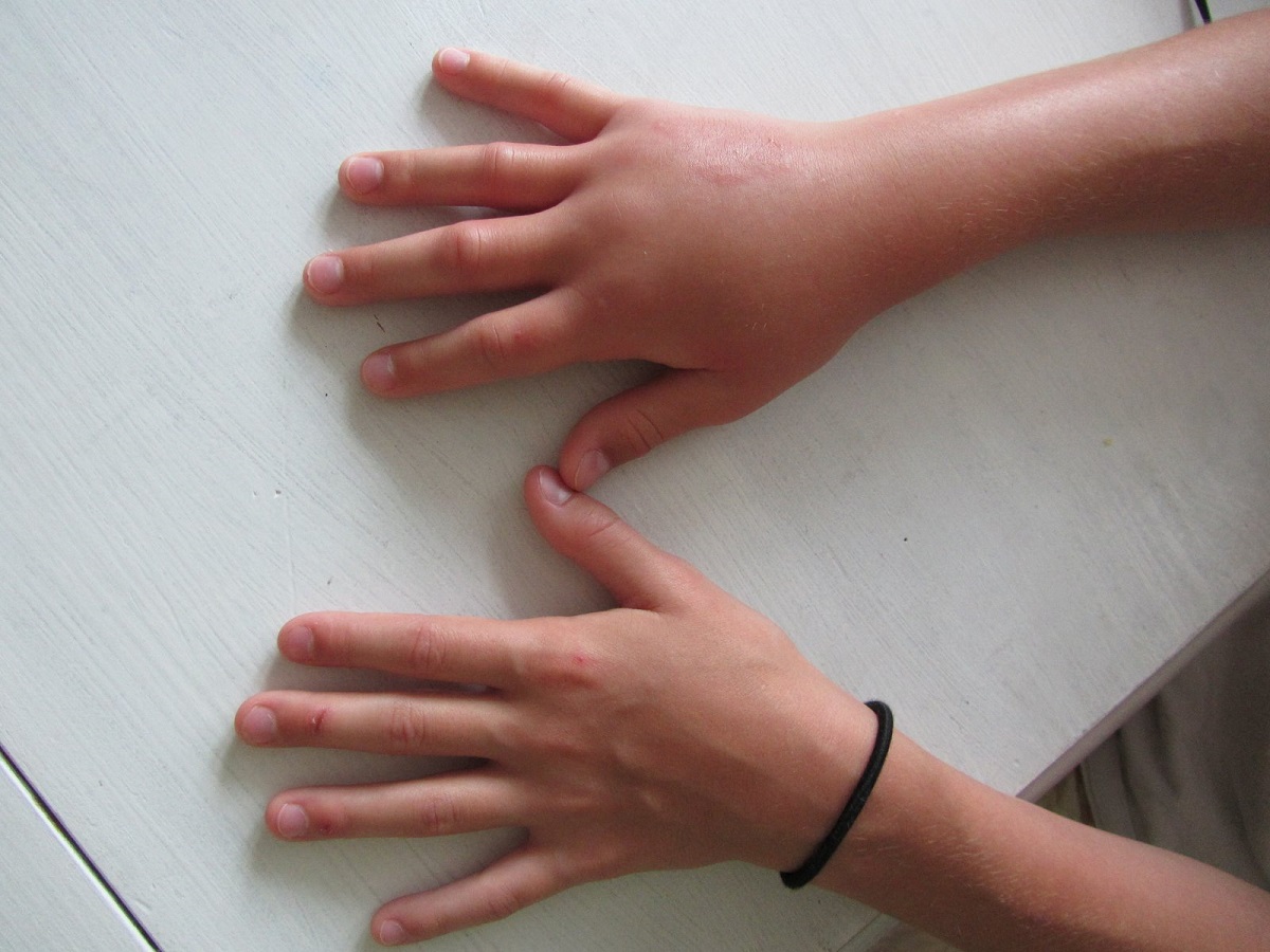 5 nguyên nhân khiến tay bị sưng phù và đau thường gặp