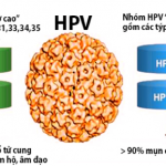 Điều trị HPV như thế nào? có ung thư cổ tử cung