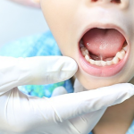 Cách chăm sóc trẻ sau phẫu thuật dính thắng lưỡi