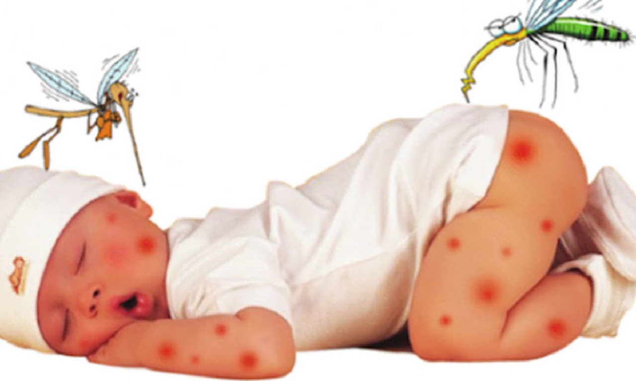 Trẻ bị muỗi cắn, bố mẹ cần lưu ý những điều gì?