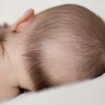 Rụng tóc ở trẻ nhỏ có phải do còi xương không?