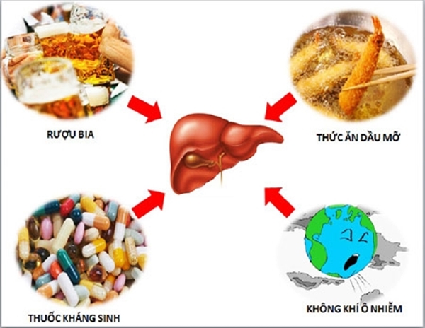 Một số nguyên nhân chính gây xơ gan còn bù như: rượu bia, yếu tố môi trường, thực phẩm,...