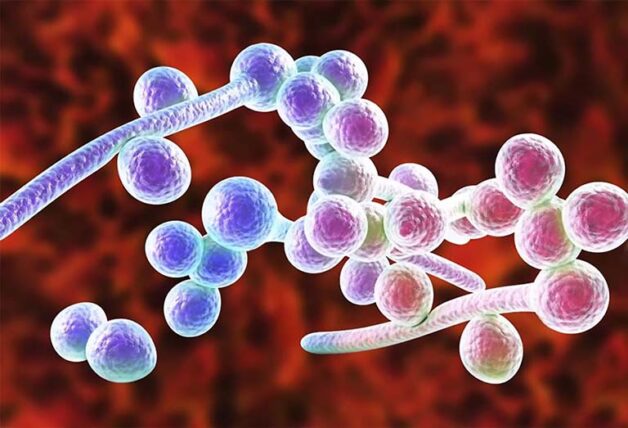 Khuẩn Candida là một trong số những nguyên nhân gây ra viêm âm đạo