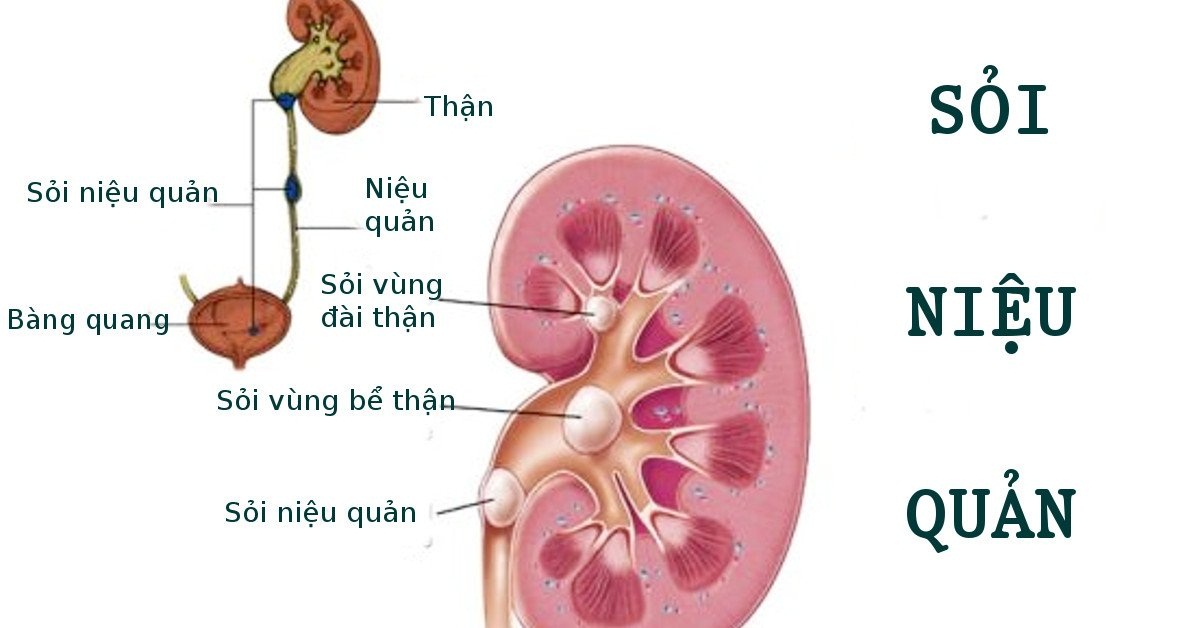 Các phương pháp soi cầu tốt nhất hiện nay